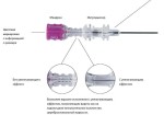 Игла для спинальной анестезии, Sprotte (Спротте) р. 27Gх3 1/2 90 мм 1 шт арт. 121251-27A с интродьюсером